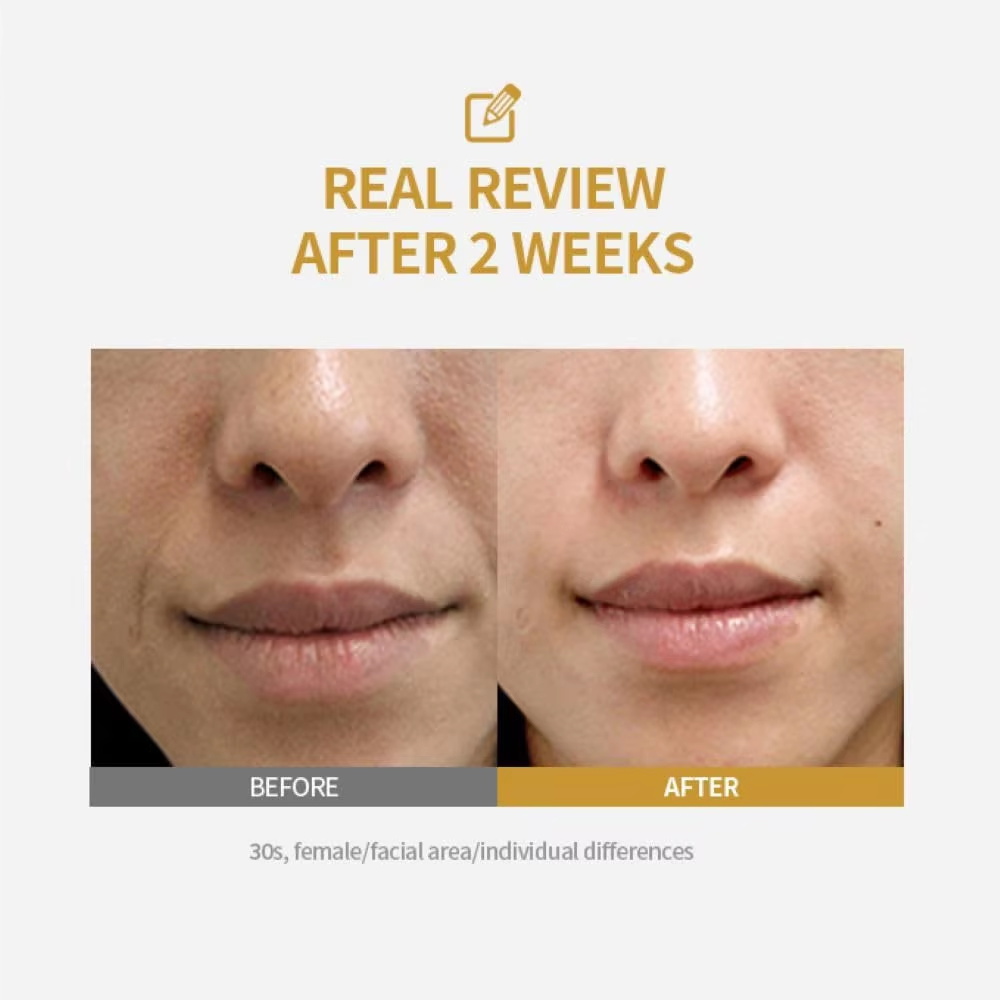 Ampul Pengencang Kulit Intensi - Collagen Peptide Powder ulasan dan harga